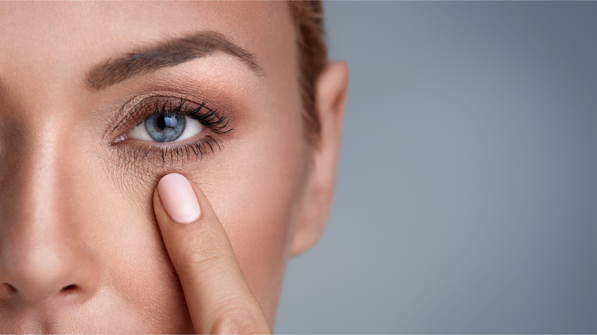 Corectie cearcane cu acid hialuronic - DermaLux Iasi