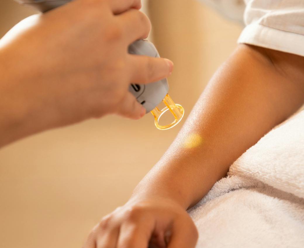 Dermatooncologie - Dermalux Iasi