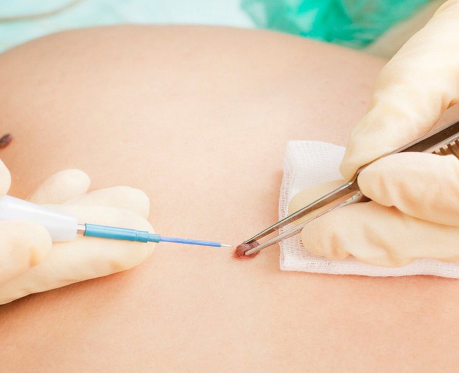 Dermatovenerologie - Dermalux Iasi
