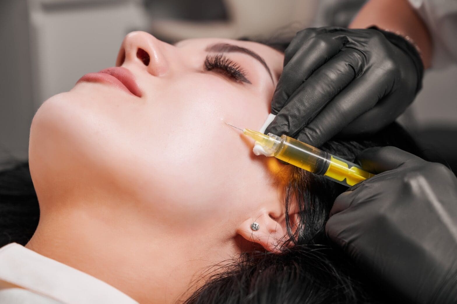 Terapia PRP – rejuvenarea naturală a pielii prin plasma bogată în trombocite - DermaLux Iasi