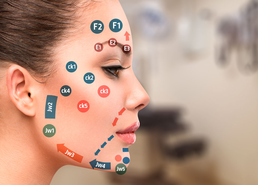 Volumizare și reconturare facială cu tehnica MD Codes™ - DermaLux Iasi