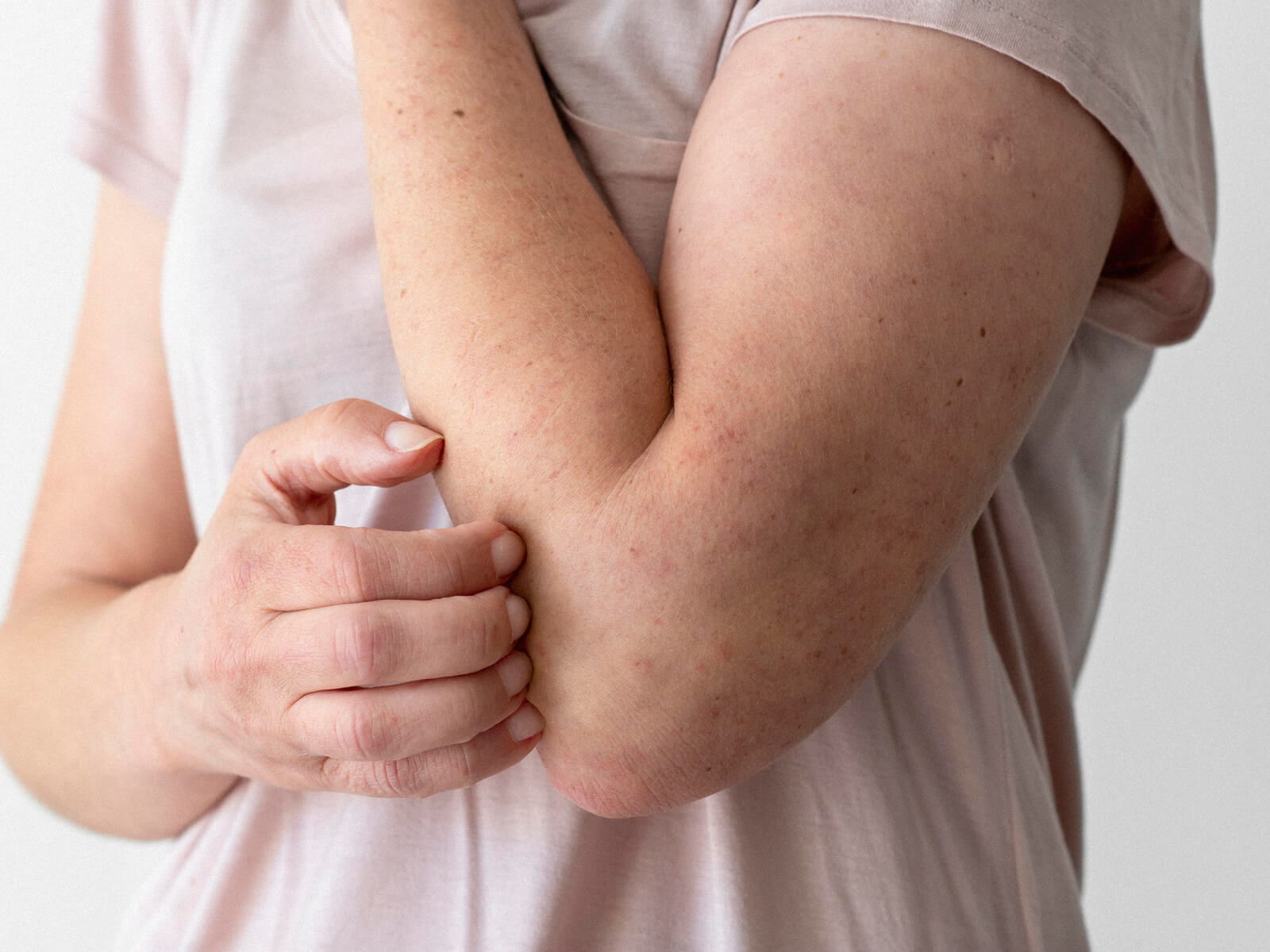 Dermatologie Medicală 3 Dermatoalergologie DermaLux Iasi